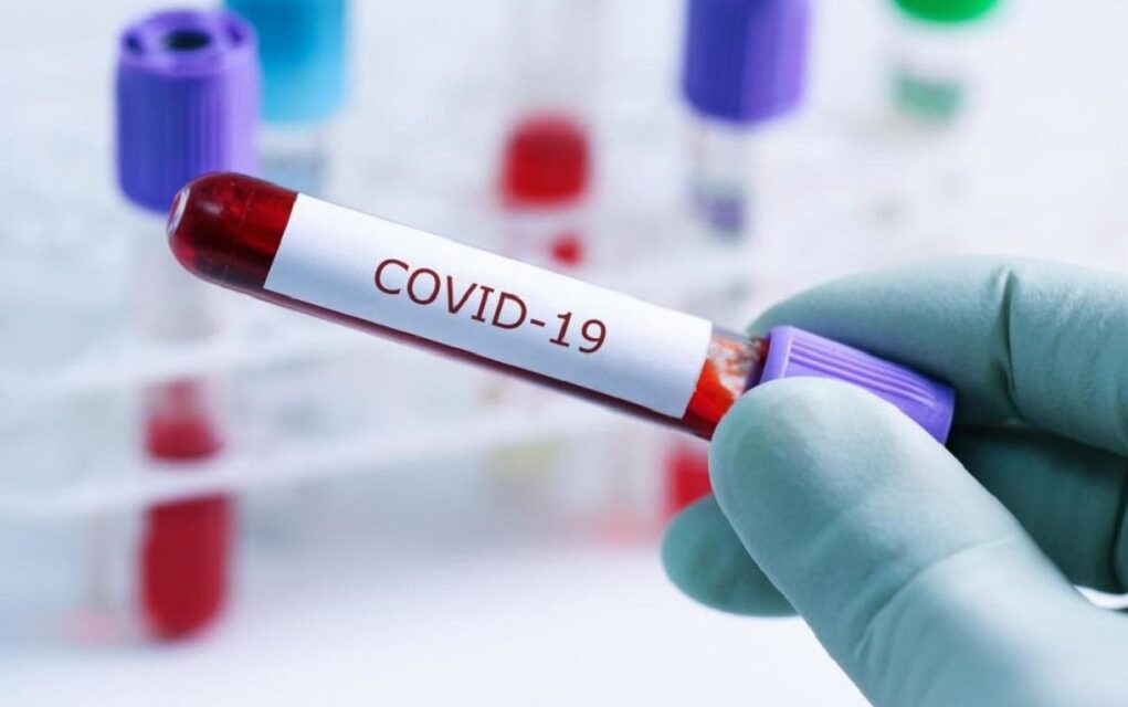 Την απροτινίνη ως νέο φάρμακο για το covid-19 προτείνουν ερευνητές